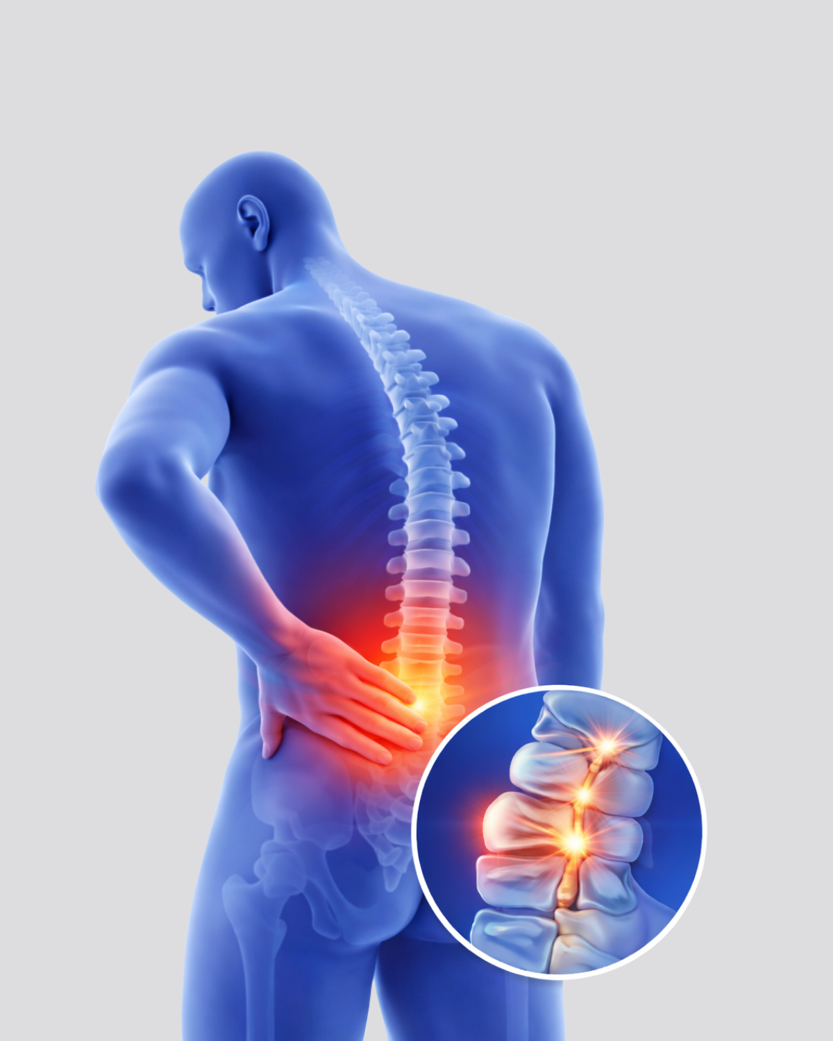 Herniated Disc