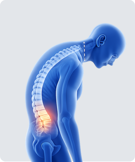 Poor Posture