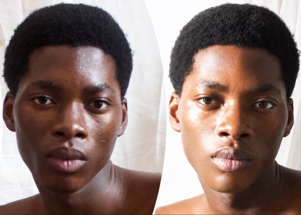 Understanding skin as colour