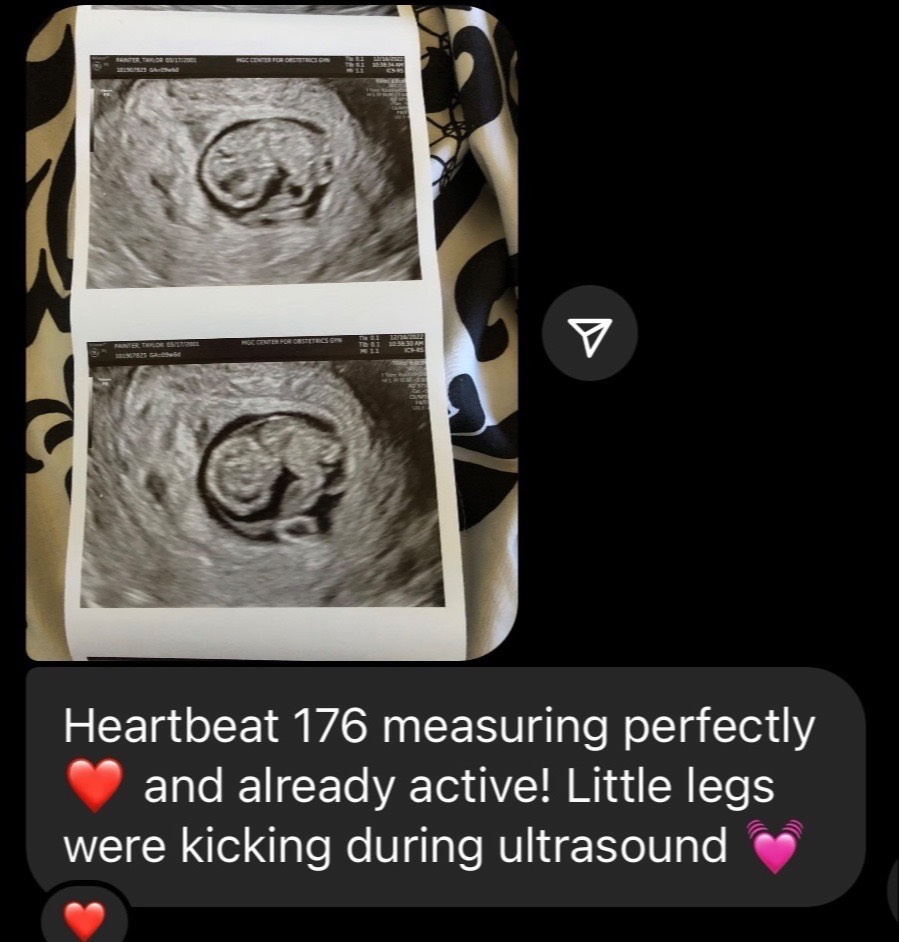 Client ultrasound update with heartbeat 176