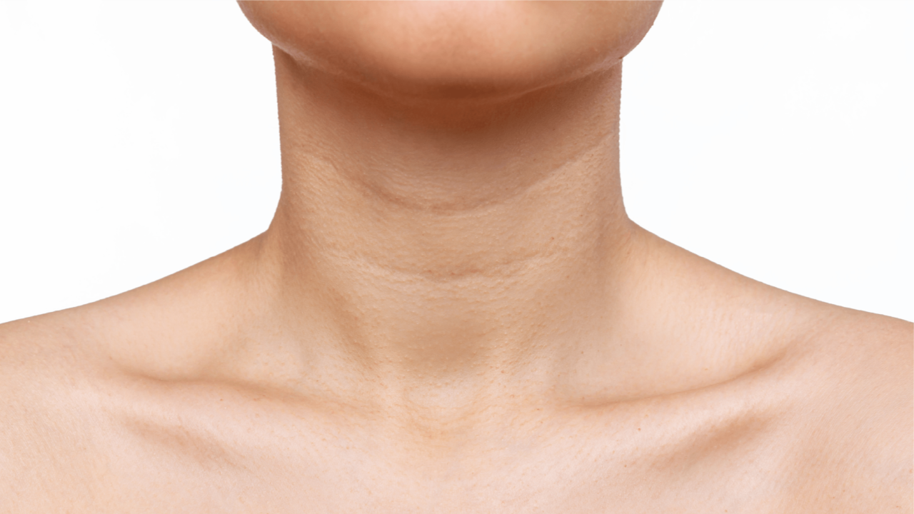Elastosis: Dermal Aging in Neck & Décolleté