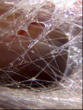 Close-up image of fascia, the connective tissue that surrounds and supports muscles, organs, nerves, and joints throughout the body.