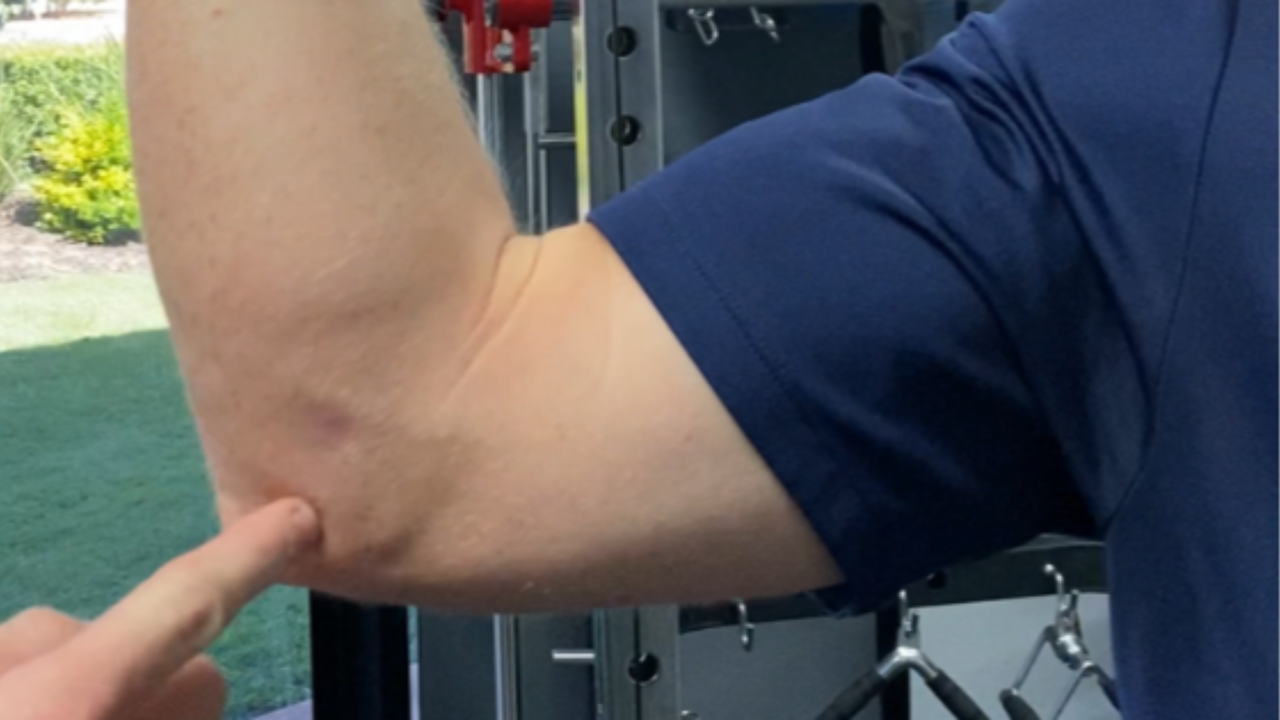 Elbow pain area in baseball players