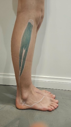 Painted lower-leg anatomy used for Soft Tissue OT learning