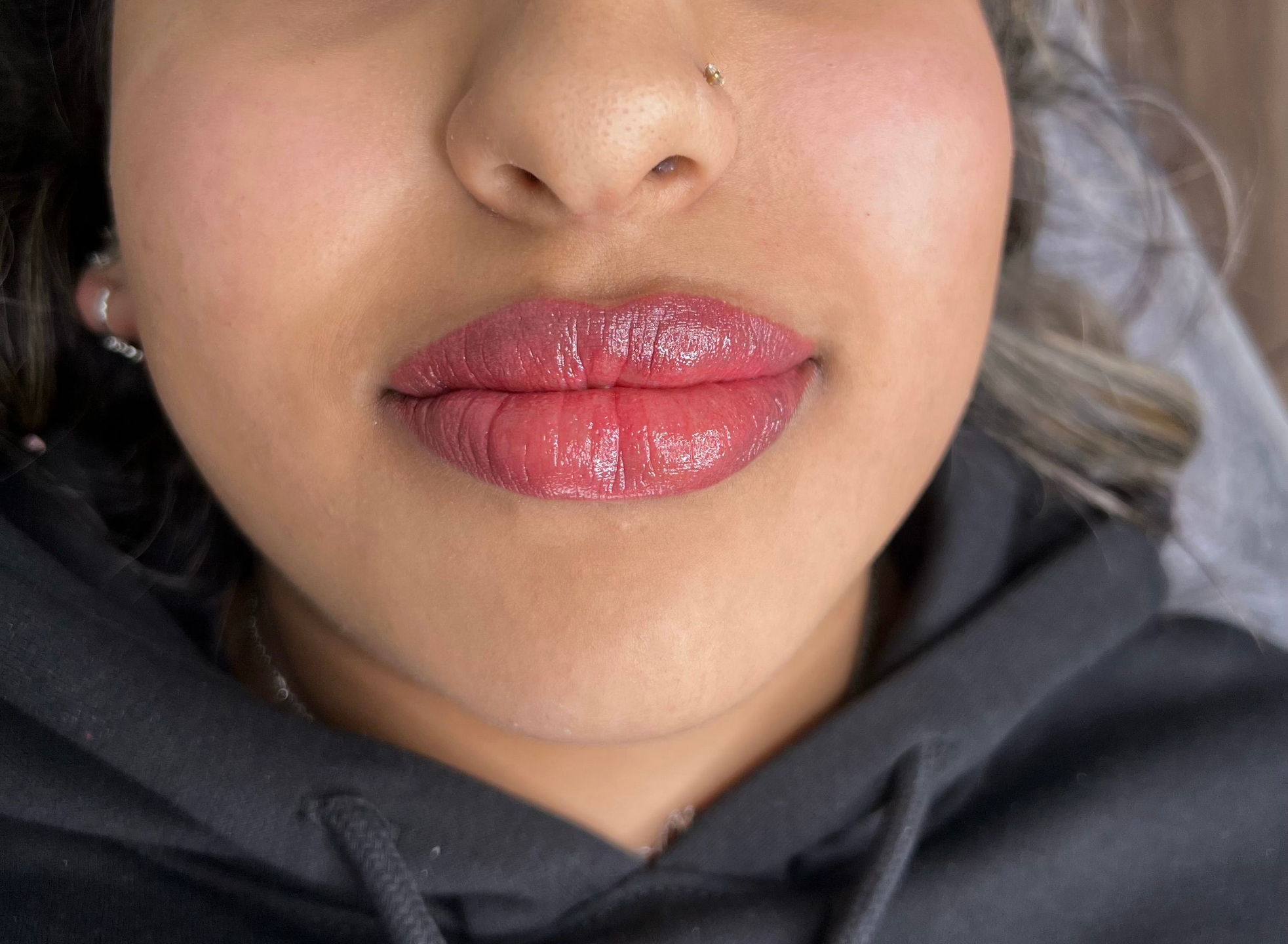 Lip Neutralisation service photo