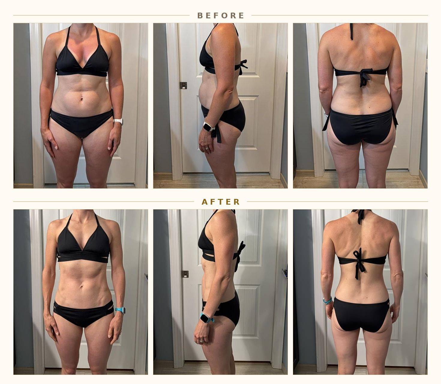 Katie E. six-angle before and after