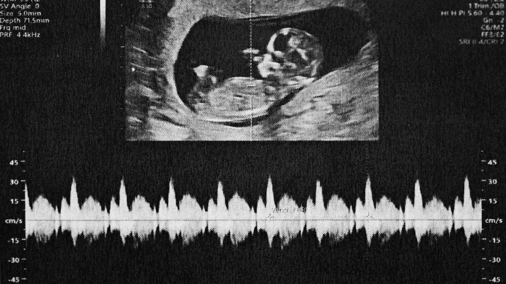 Ovēa Birth scan review photo