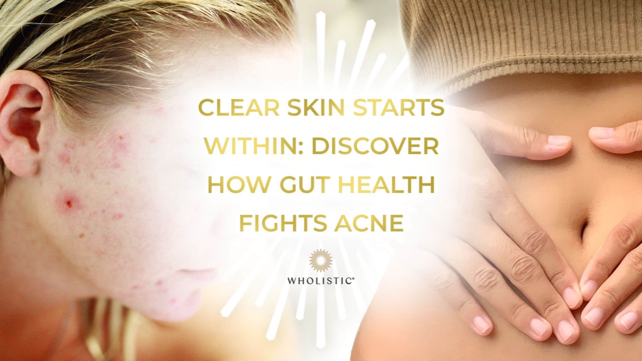 Clear Skin Starts Within: Discover How Gut Health Fights Acne