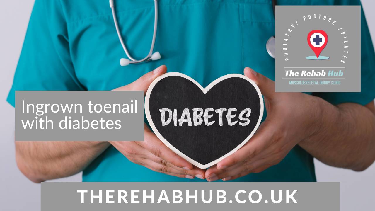 Ingrown toenail with diabetes