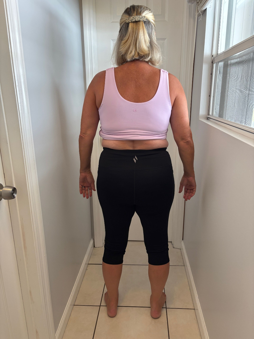 Natalie before LumaBody back view