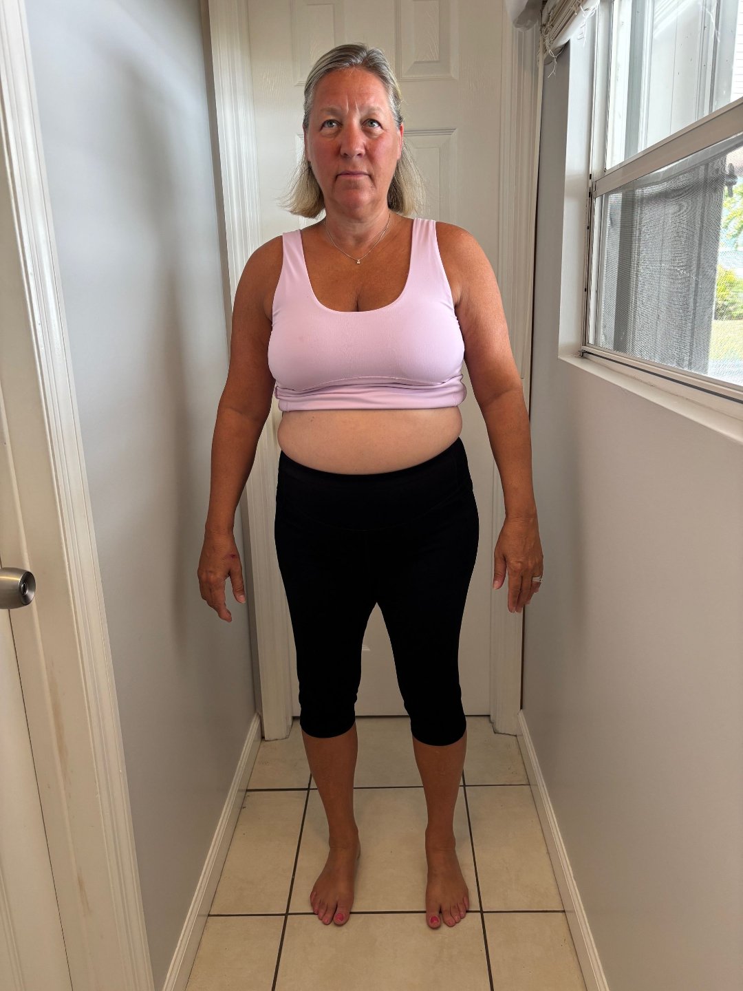 Natalie before LumaBody front view