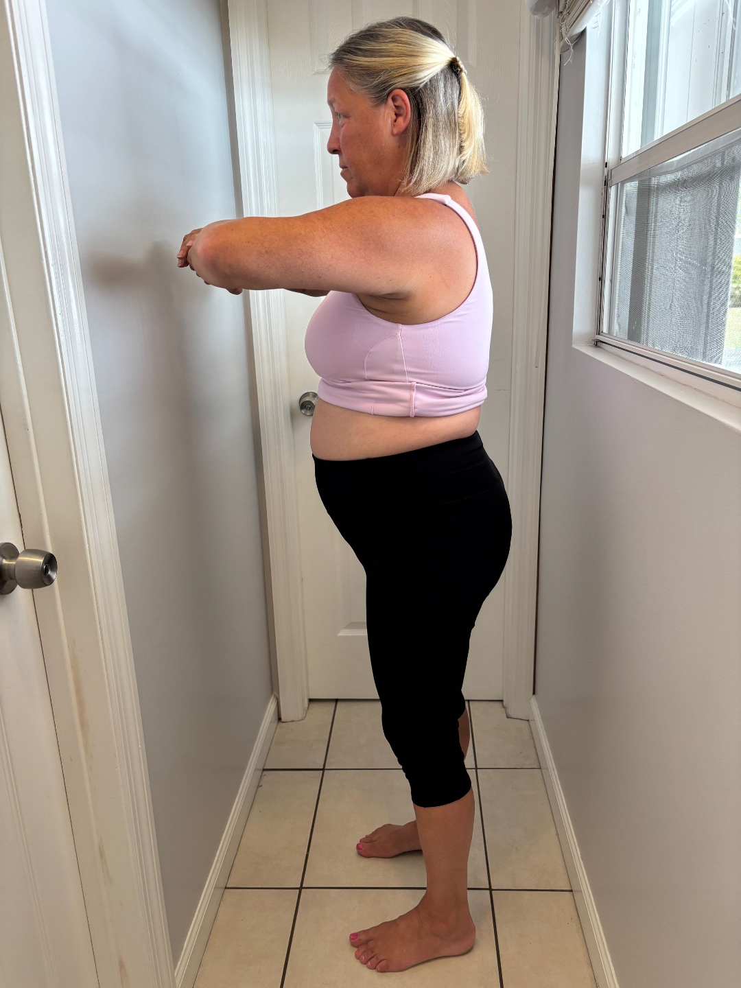 Natalie before LumaBody side view