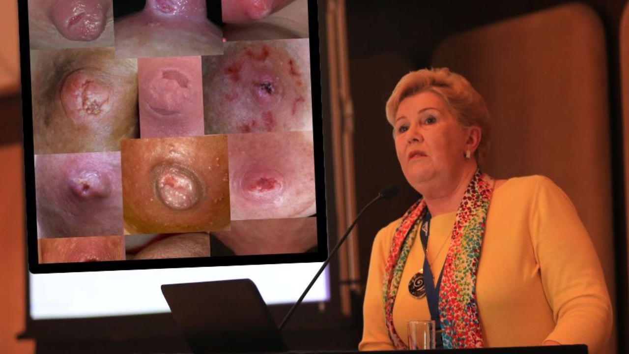 Dr Robyn Thompson, Presenting her research at ICM Conference, 2014