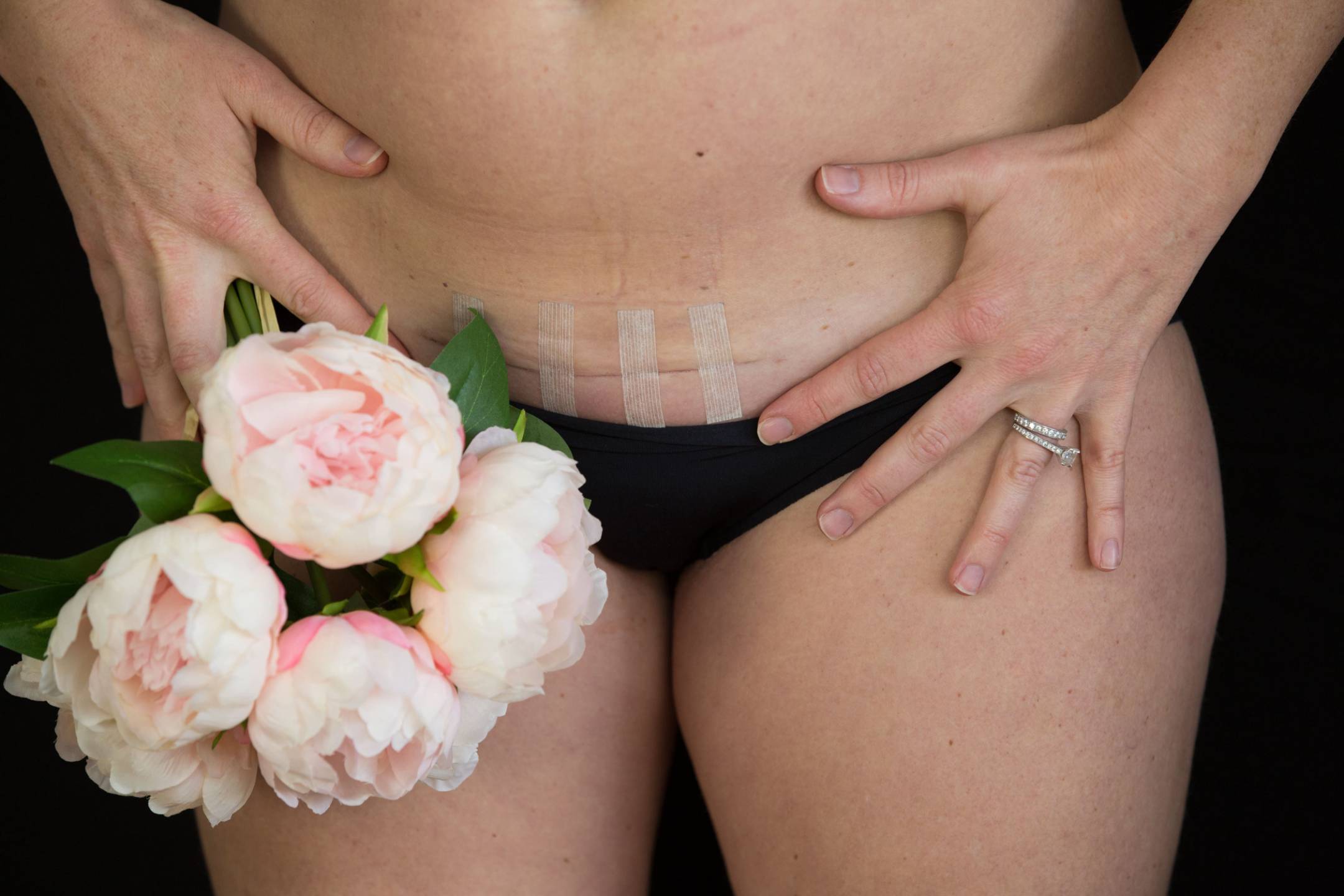 pregnancy pelvic girdle pain safe exercise