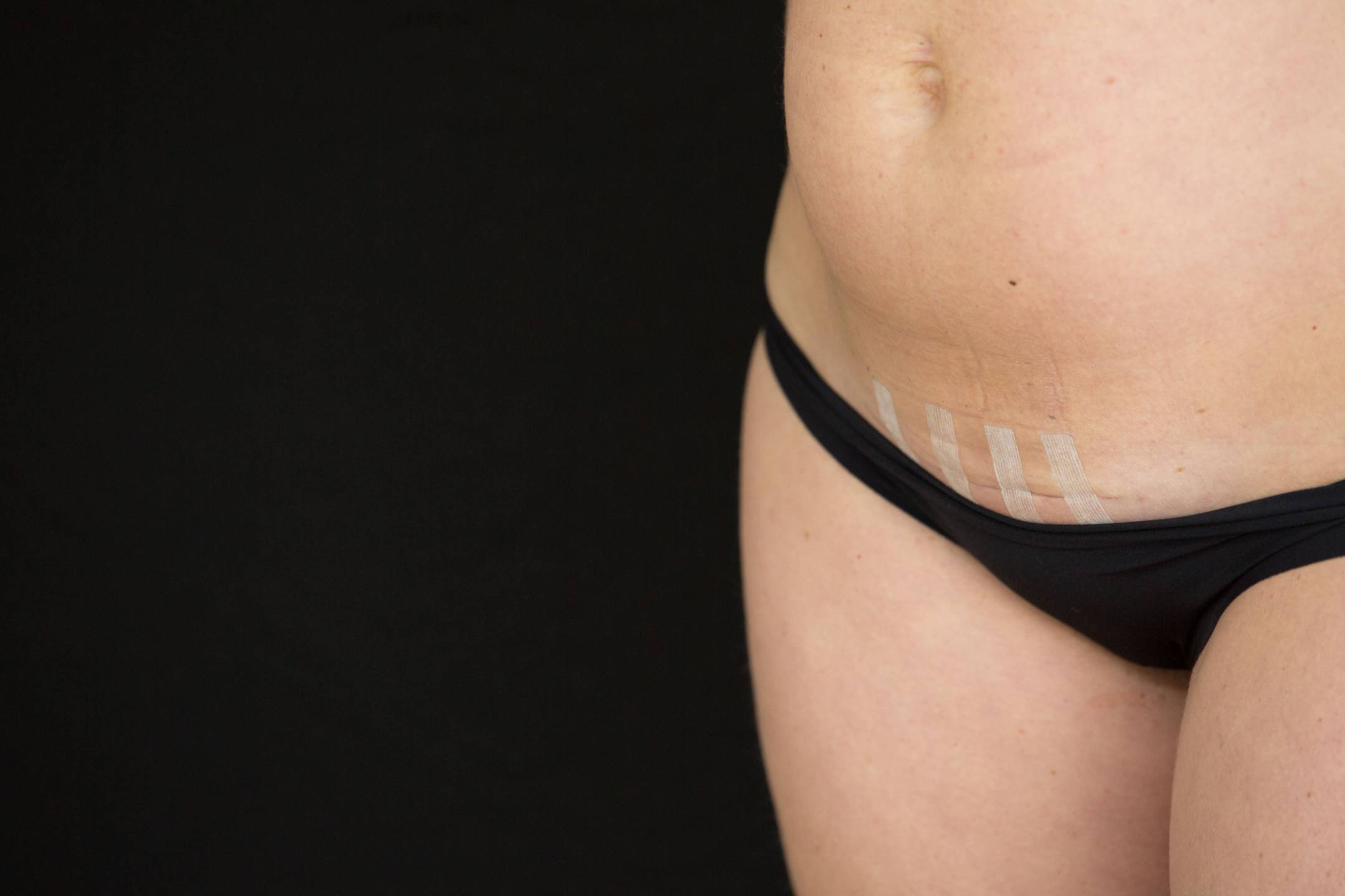 pregnancy pelvic girdle pain safe exercise