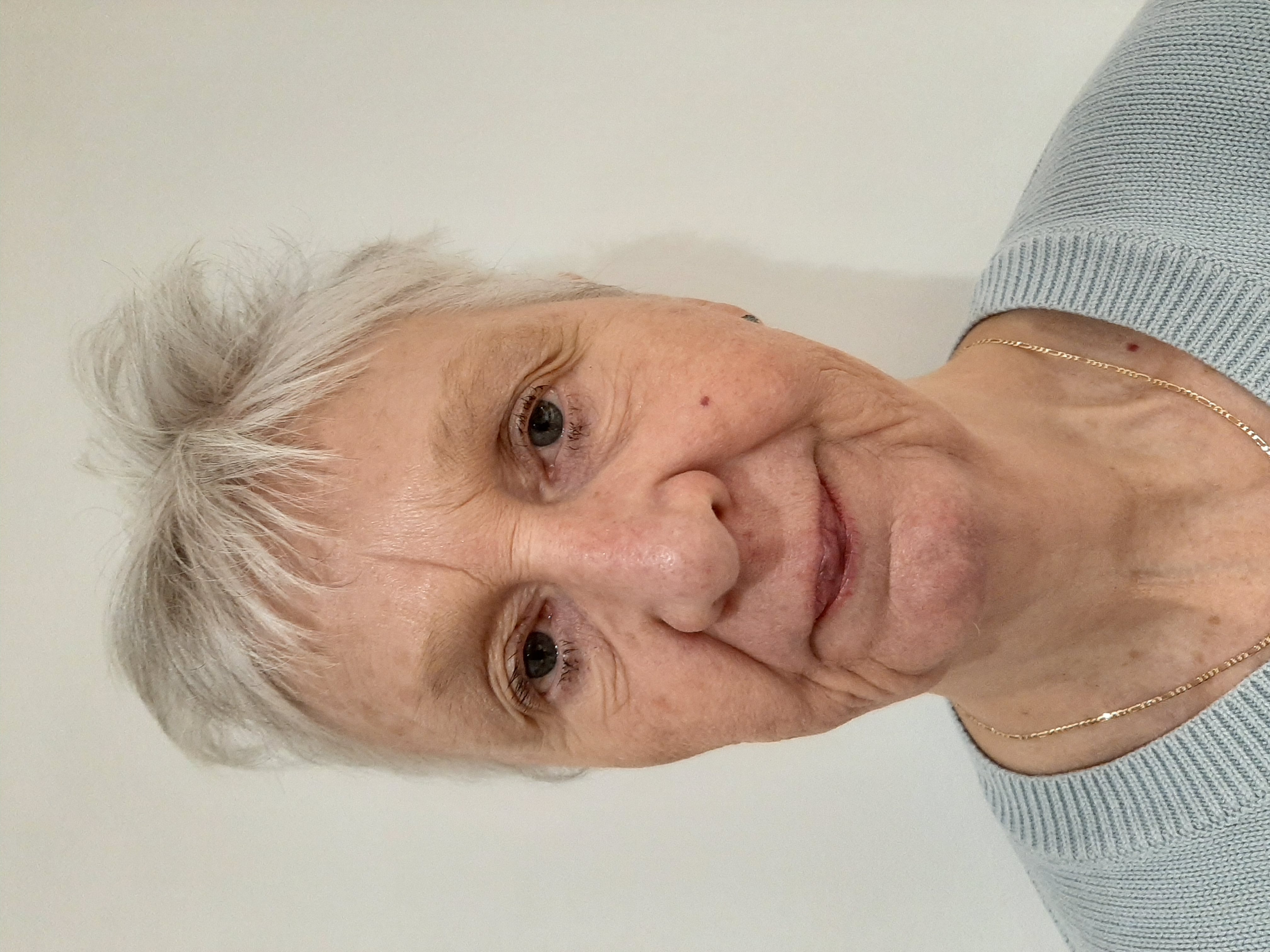 Tricia, before treatment