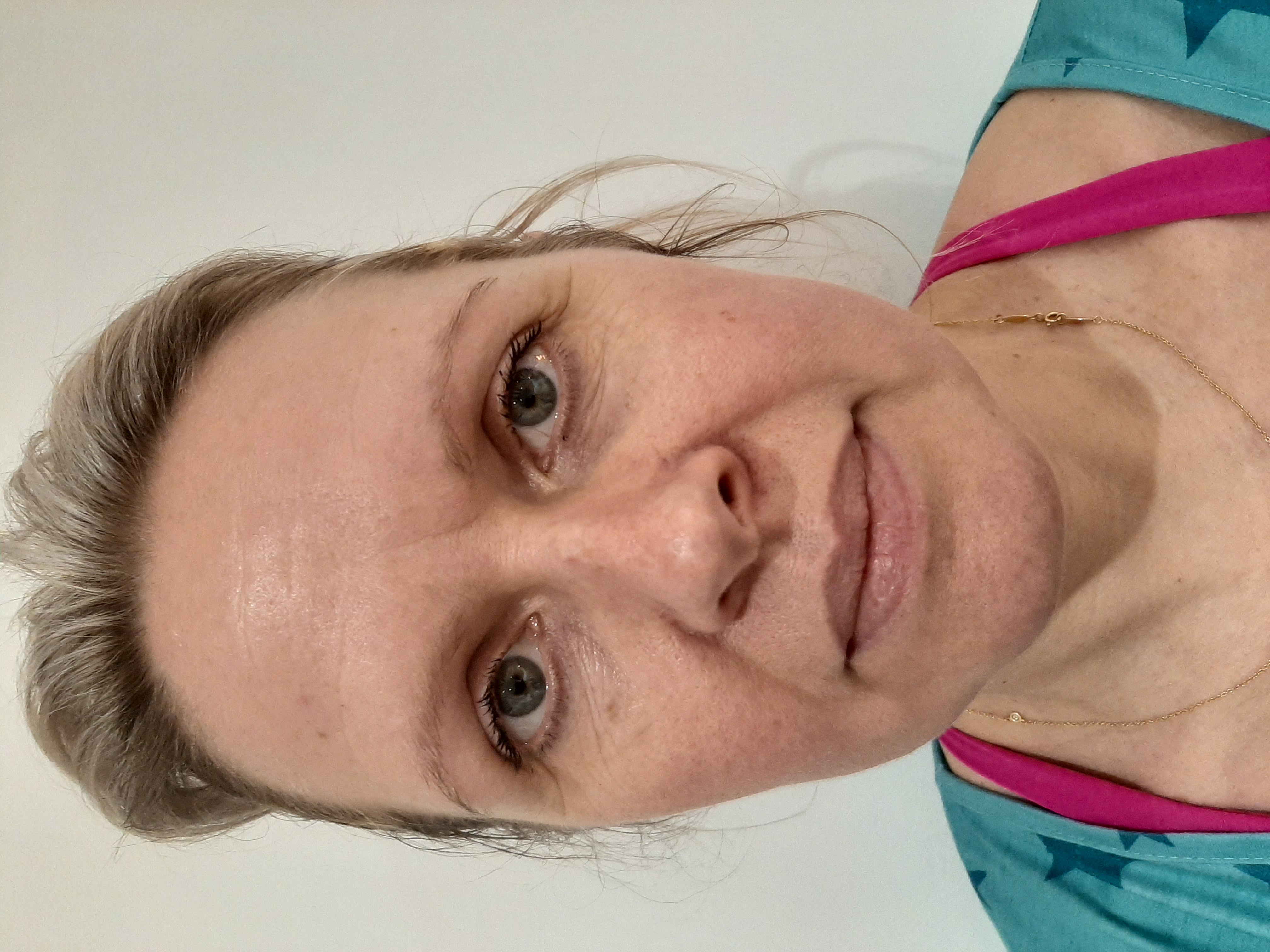 Katie, before treatment