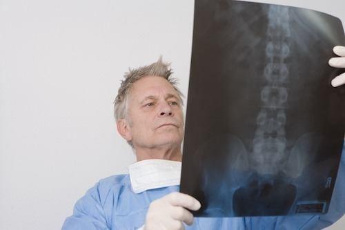 doctor looking at x-ray for back pain