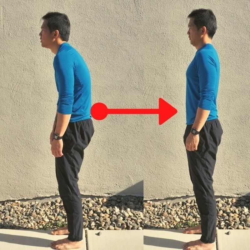 hunchback posture transformation