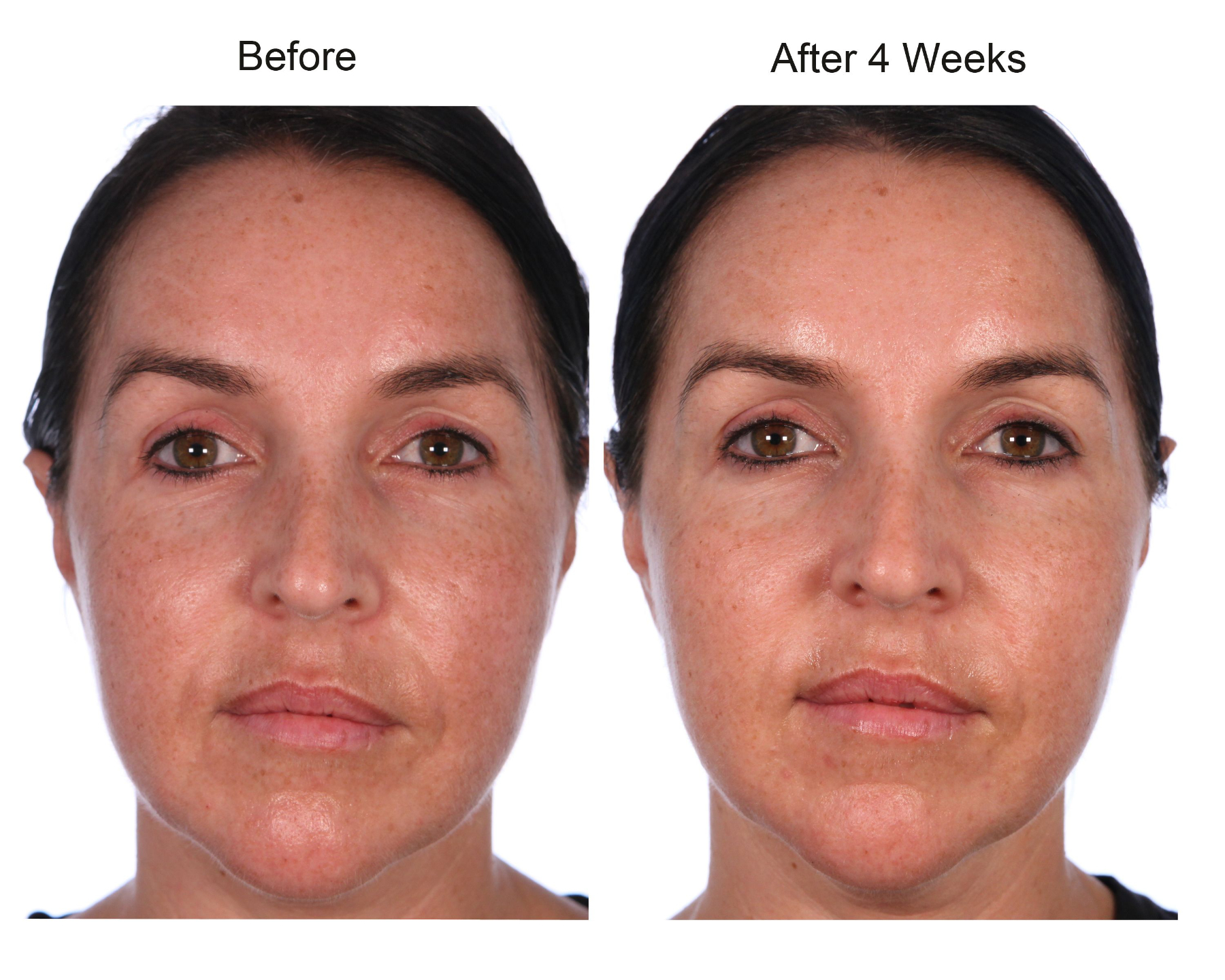 Collagen Supplement Before And After Best Collagen For Skin