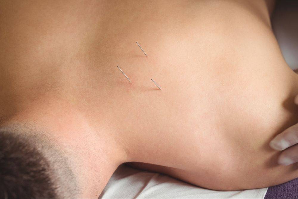 Athletes' Potential physical therapist working one-on-one with a patient during a full-hour dry needling and manual therapy session in Decatur, GA