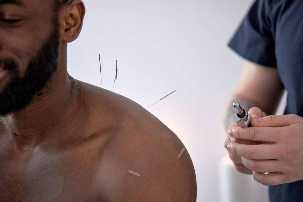 Doctor of Physical Therapy performing dry needling treatment on a patient at Athletes' Potential clinic in Decatur, GA