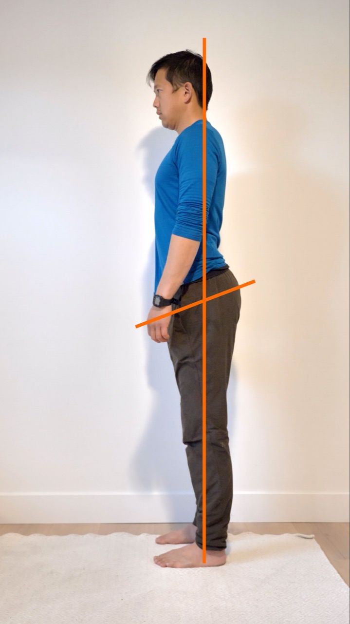 anterior pelvic tilt example