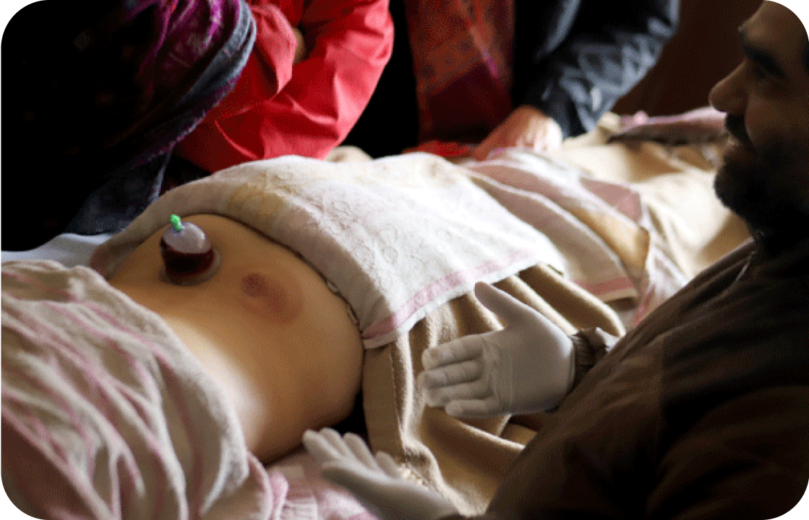 Ayurvedic Cupping Therapy at Ayuskama Ayurveda