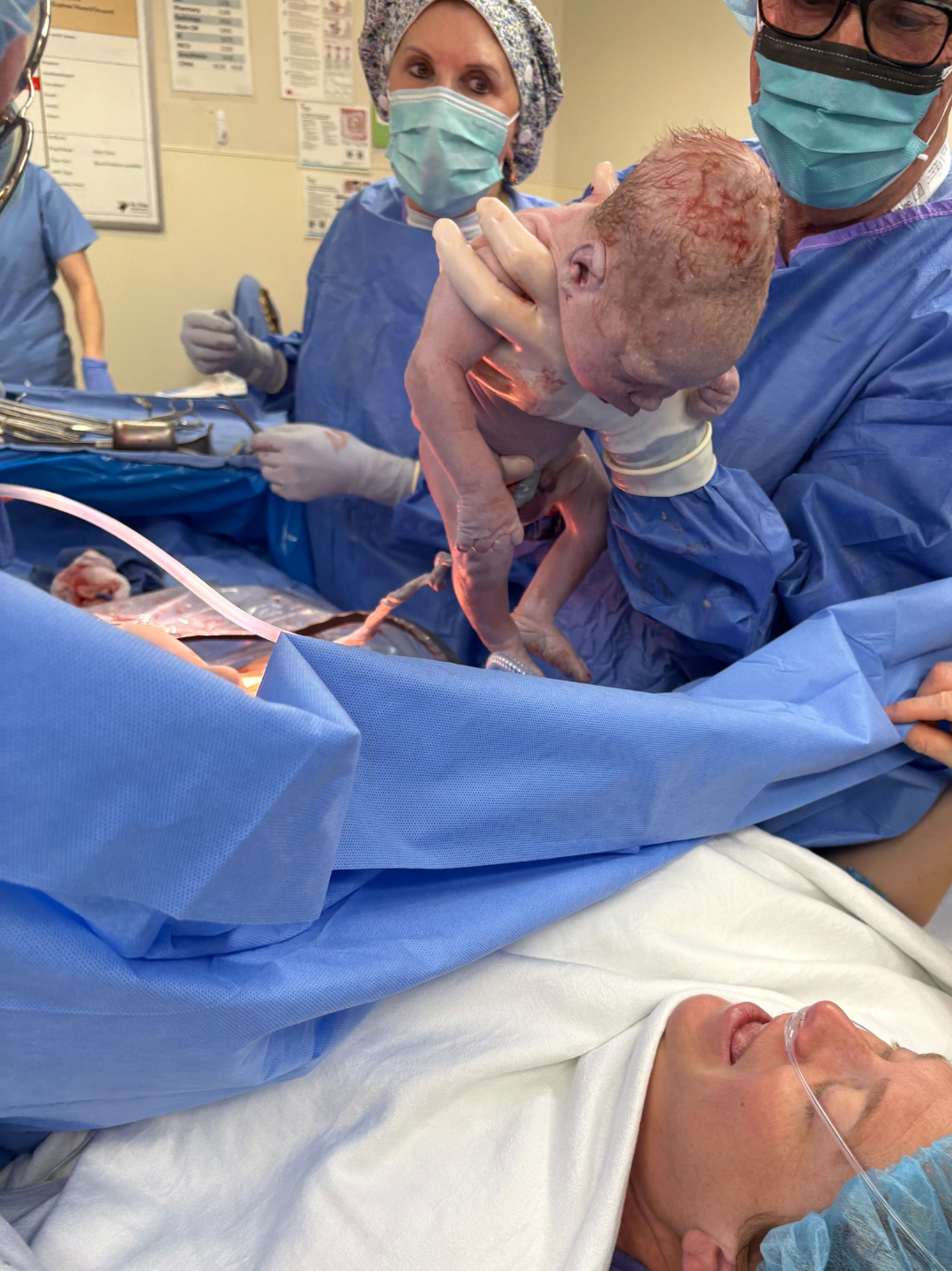 Newborn being held over surgical curtain.  New mom is seen smiling at her new baby boy.