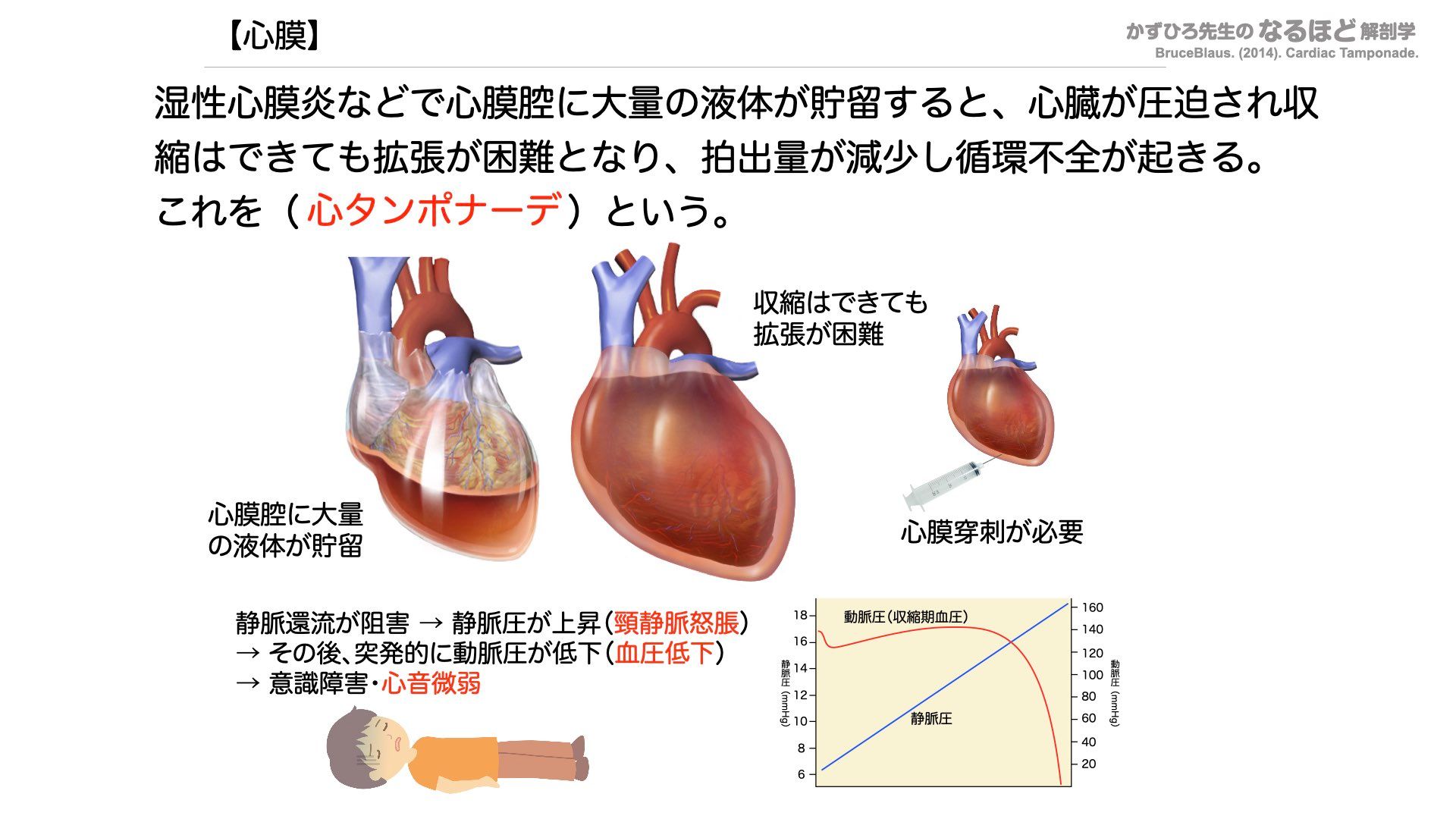 一問一答スライド