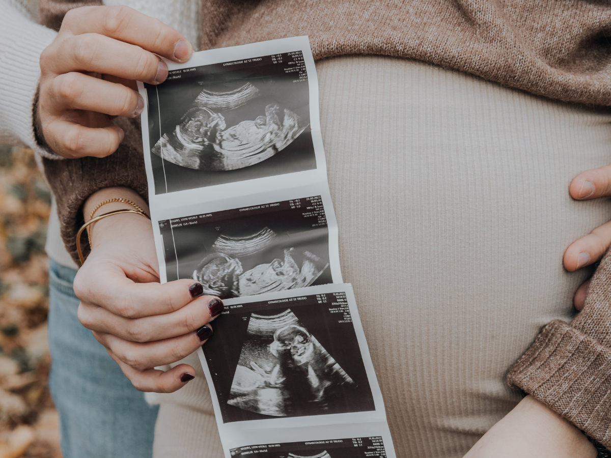 breastfeeding success starts before baby arrives