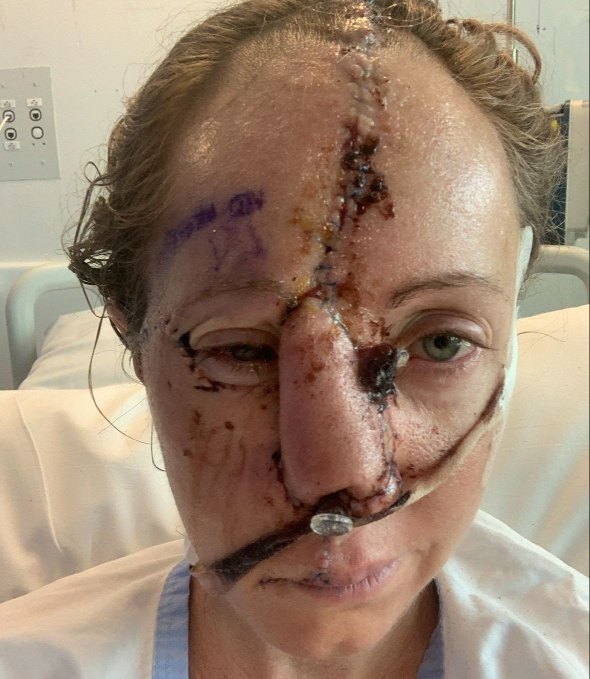 Weight loss consultation with Townsville nutritionist