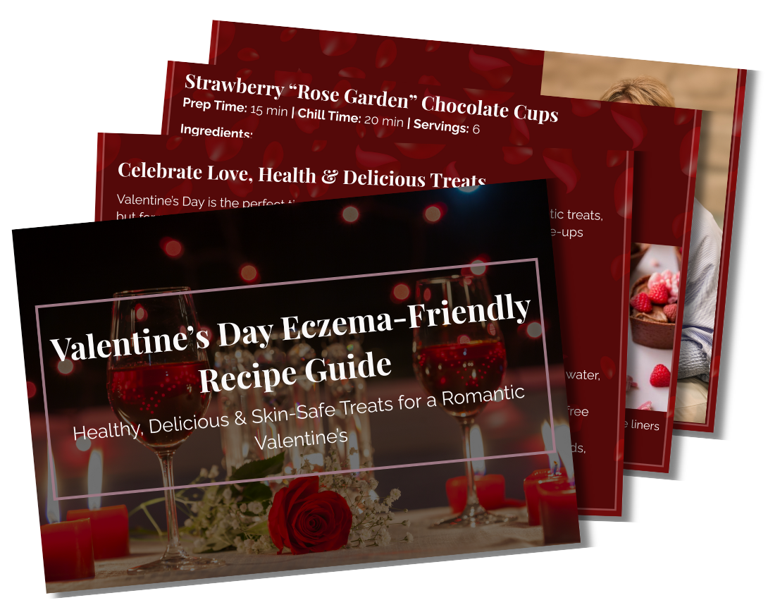 Free Eczema-Safe Valentine's Recipe Guide