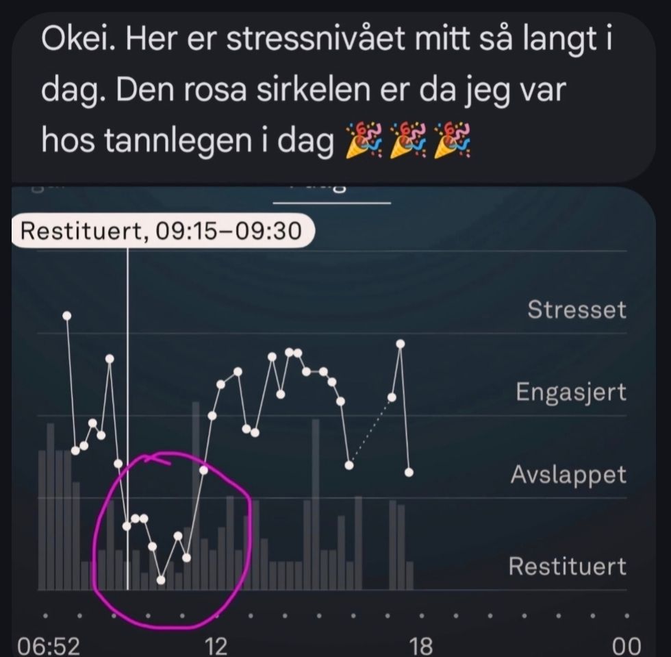 Stressnivå-måling som viser rolig tilstand under tannlegebesøk