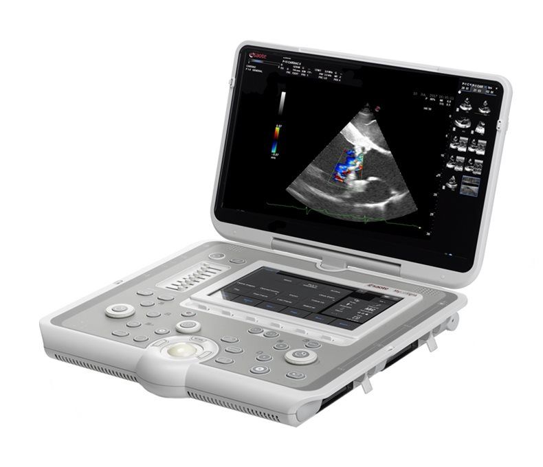 MyLab Sigma machine review by FOVU