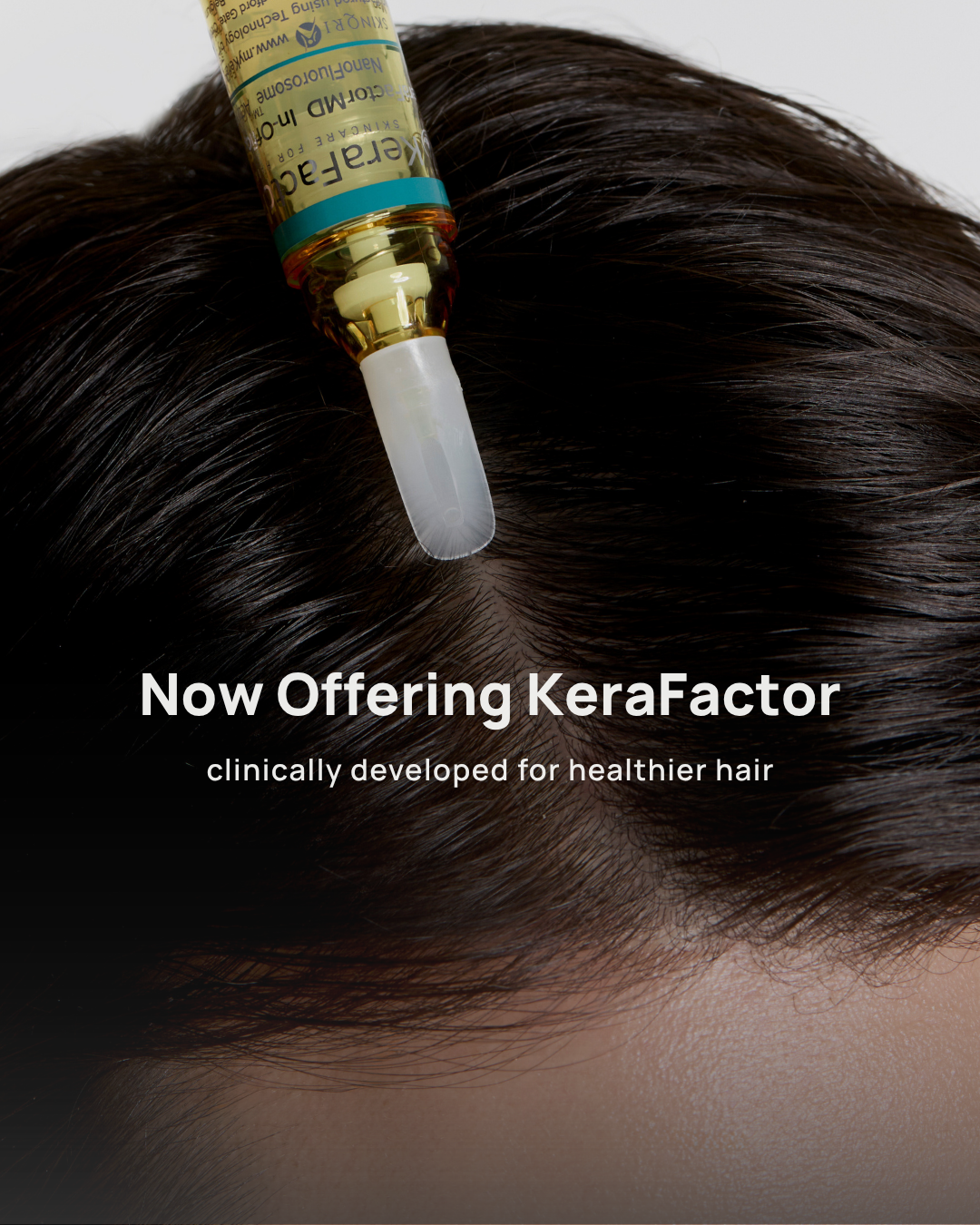 Dr. Schneider with IPL device