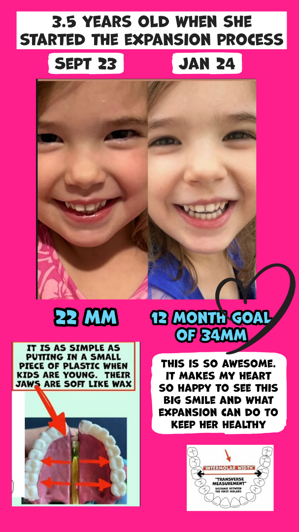 Video Poster Image