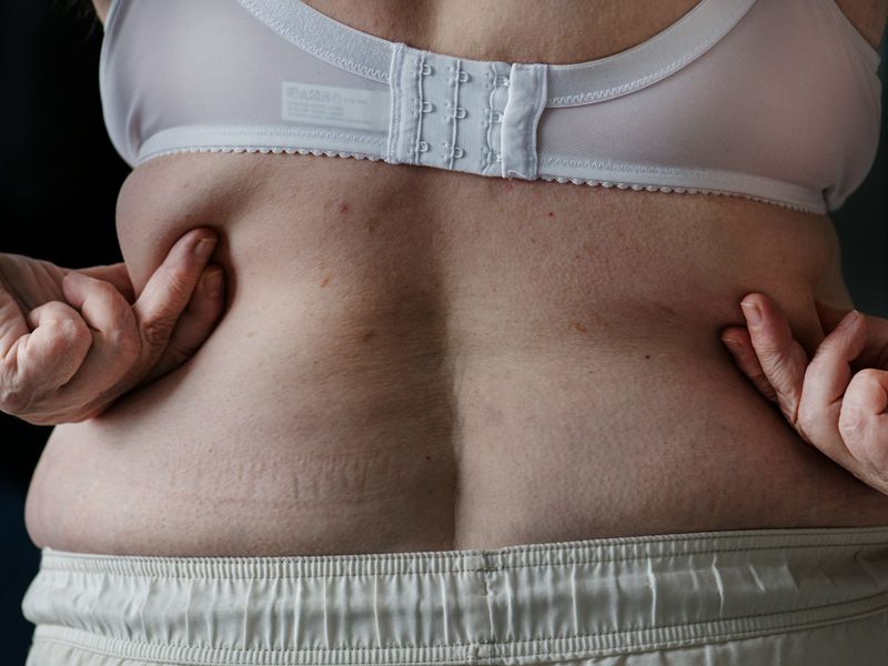 Close-up of a person gently holding their waist, symbolising body confidence, self-acceptance, and the journey towards healthy weight loss — Retrained Minds Hypnotherapy.