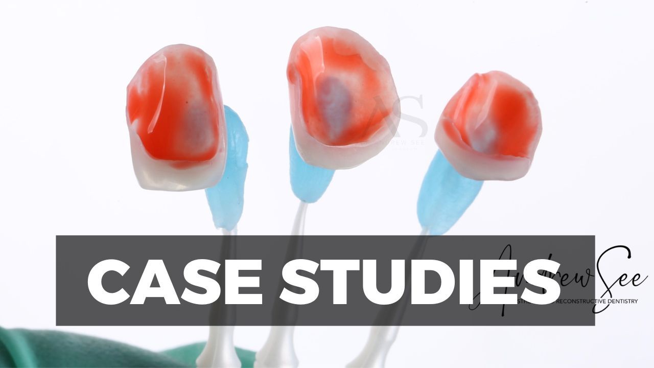 Mastering Porcelain Veneers with Dr Andrew See