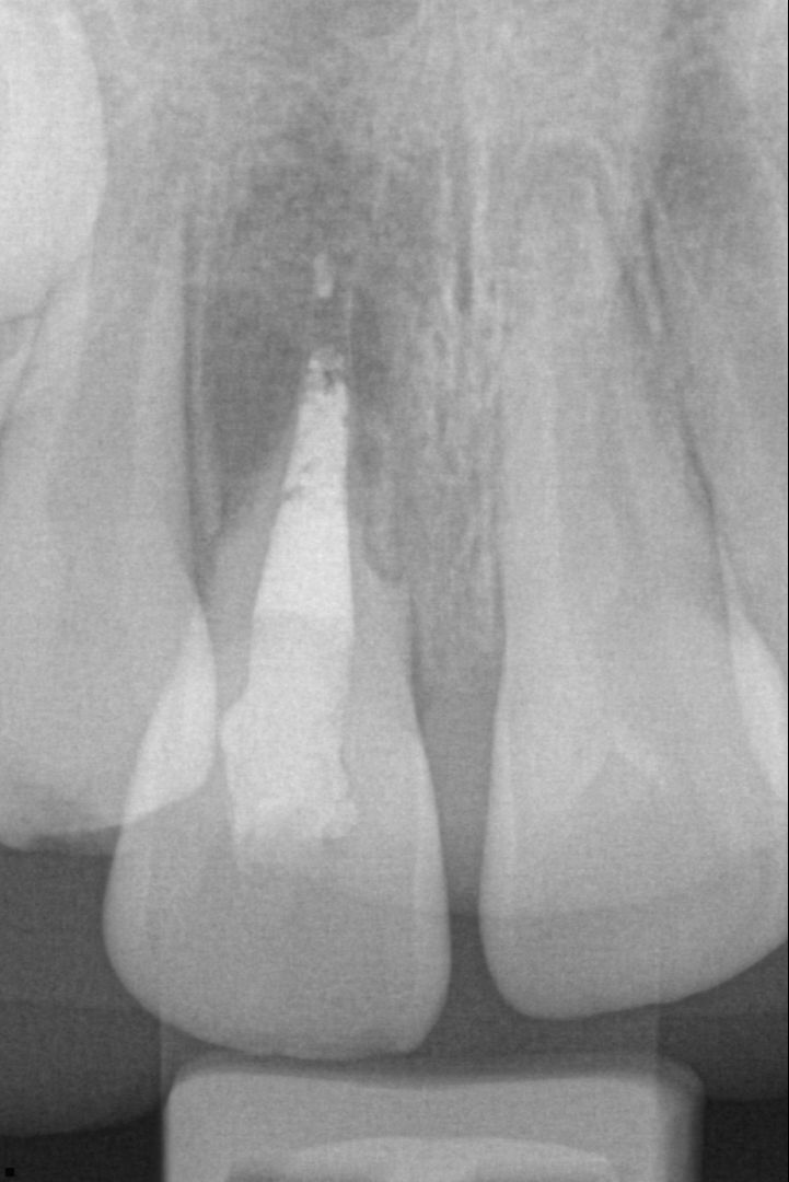 Teach Me to Be a Laser Dentist - A Crash Course on Diode Lasers and Restorative Dentistry With Dr Ron Kaminer-Live Demonstration Webinar