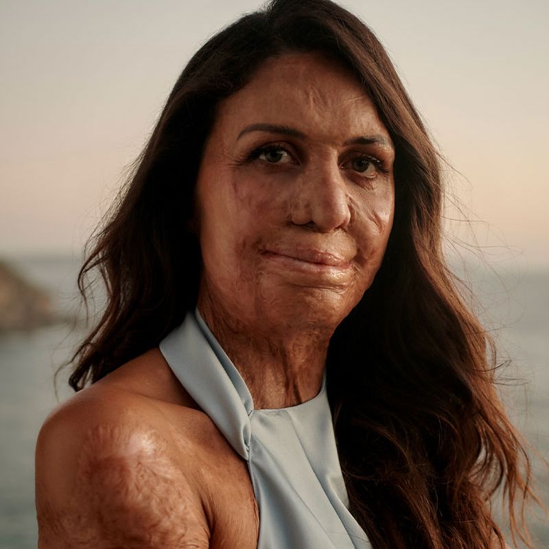Turia Pitt's story