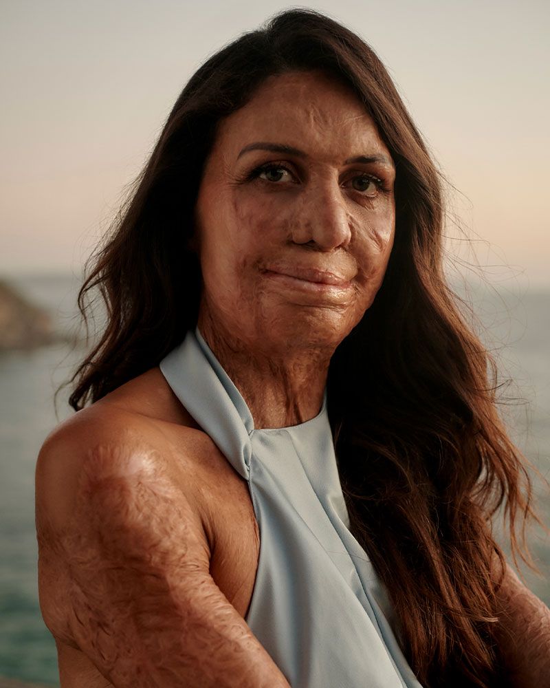 Turia Pitt's story