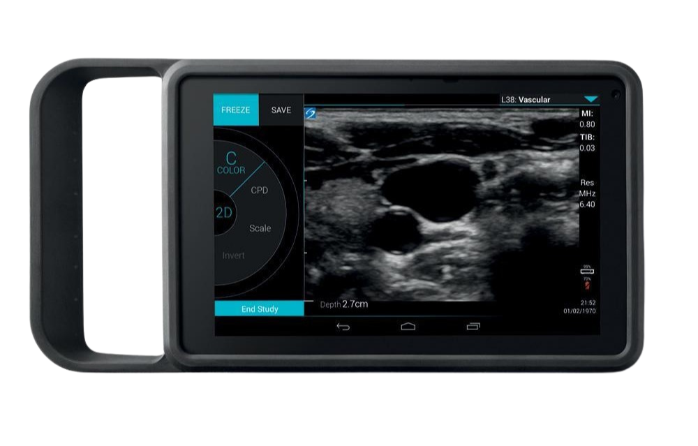 iViz machine review by FOVU