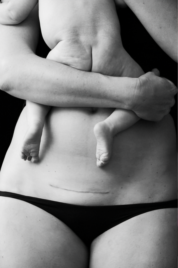 pregnancy pelvic girdle pain safe exercise