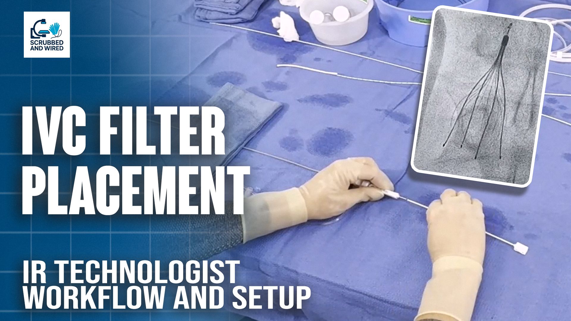 Imagen del póster del vídeo