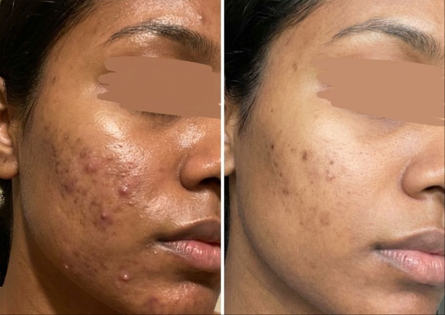 Client skincare progress