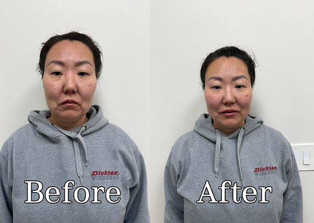 Before and after comparison: on the left, the woman looks uncertain and slightly tense; on the right, she looks confident, relaxed, and gently touching her face.