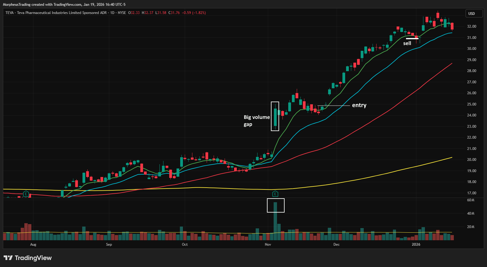 Wagner Daily Trade Setup Example - TEVA Pharmaceutical