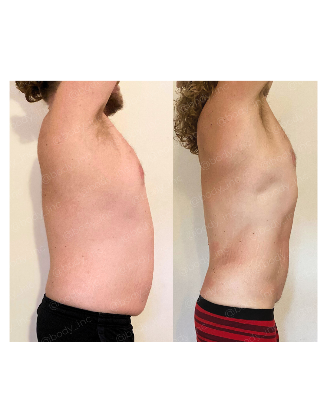 Client transformation - Patrick