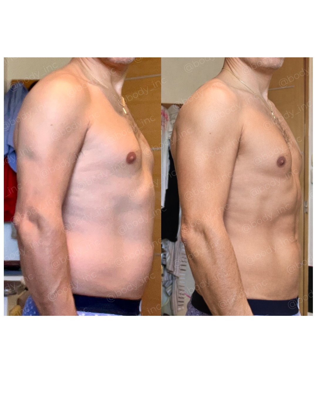 Client transformation - Patrick